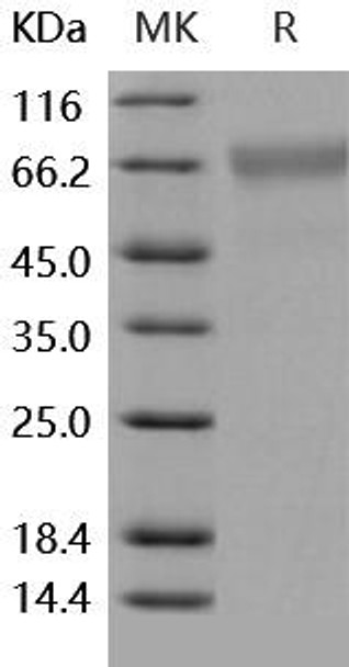 Human BACE1/ASP2 Recombinant Protein  (RPES0508)
