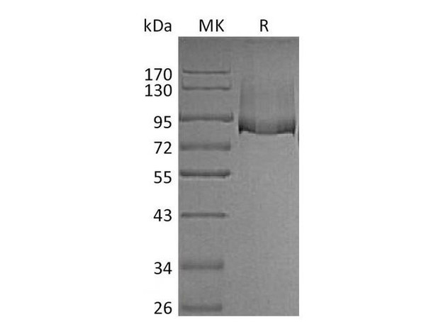 Mouse Thrombomodulin/THBD Recombinant Protein (RPES0556)