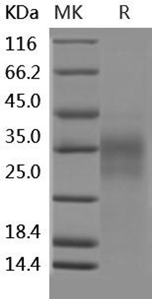 Human CD153/CD30L/TNFSF8 Recombinant Protein (RPES0576)