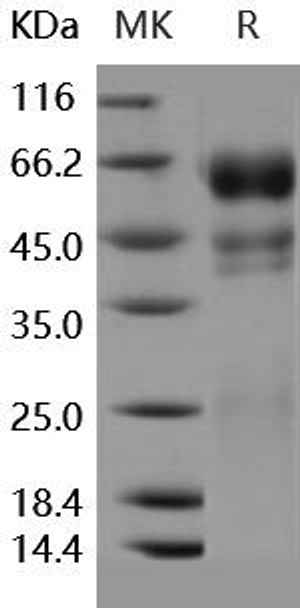 Human PROC1/Protein C/PROC Recombinant Protein (RPES0580)