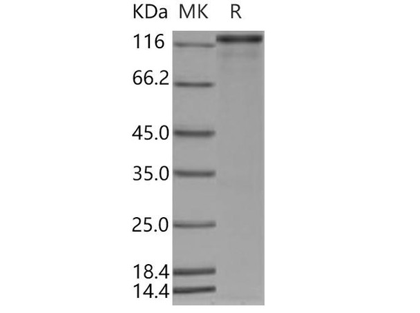 Human p63 Recombinant Protein (RPES0596)