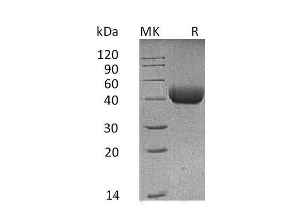 Mouse SFTPD/SP-D Recombinant Protein (RPES0708)