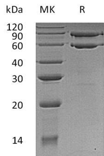 Human COL8A1 Recombinant Protein (RPES0805)