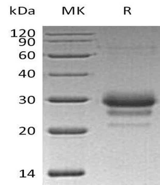 Human TFPI2 Recombinant Protein (RPES0844)