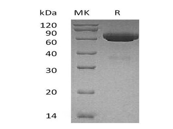 Human tPA/PLAT Recombinant Protein (RPES0900)