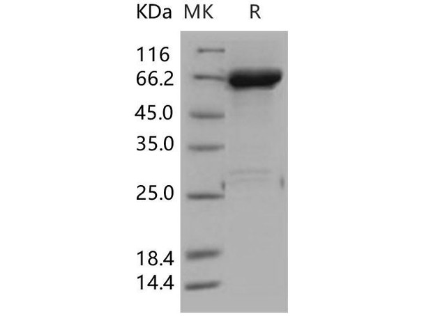 Human JNK1/MAPK8 Recombinant Protein (RPES0910)