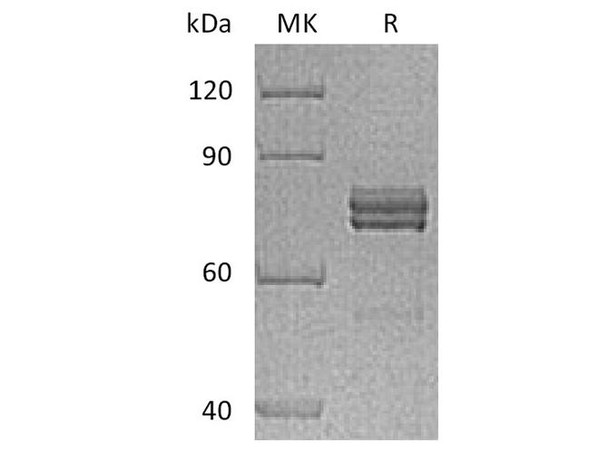 Human CTGF/CCN2 Recombinant Protein (RPES0970)