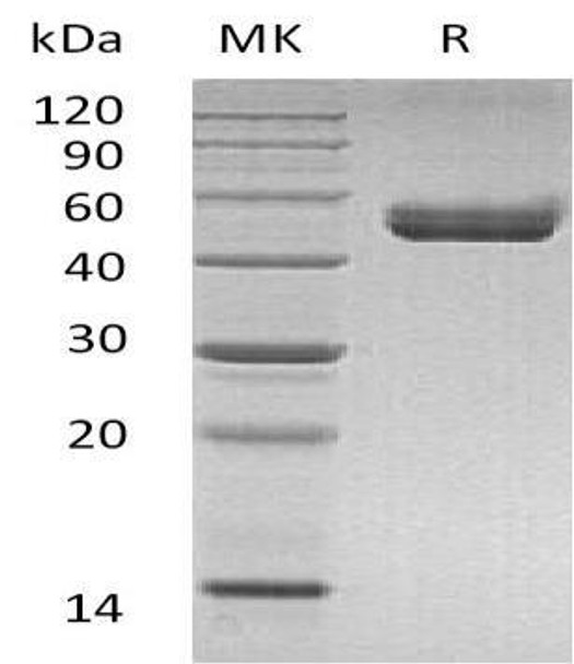 Mouse CD74 Recombinant Protein (RPES1010)