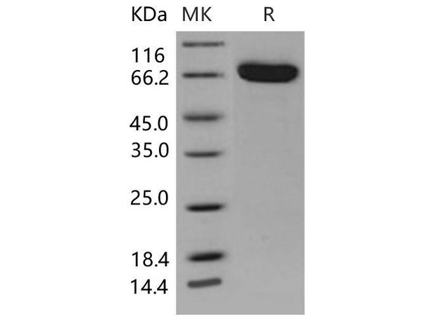 Mouse EphB4/HTK Recombinant Protein (RPES1019)