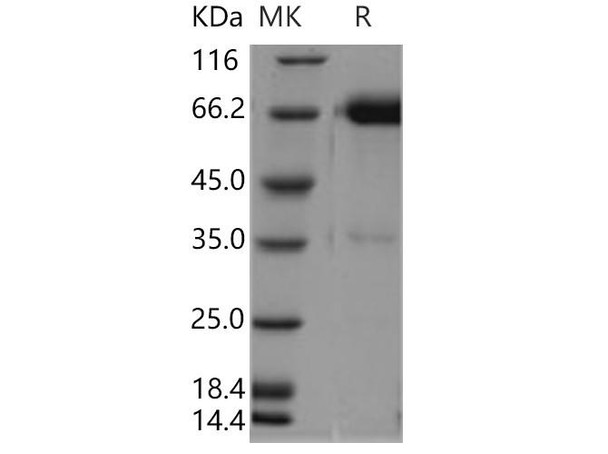 Human Tissue Factor/CD142 Recombinant Protein (RPES1031)