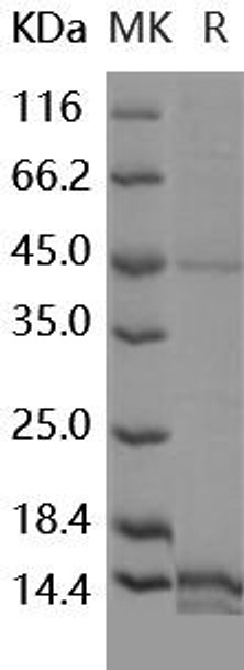Human EG-VEGF/prokineticin Recombinant Protein (RPES1311)