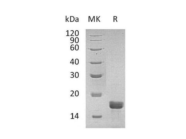 Mouse Interleukin-2/IL-2 Recombinant Protein  (RPES1396)