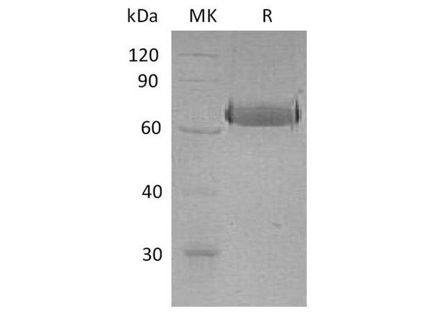 Human EphA2 Recombinant Protein (RPES1425)