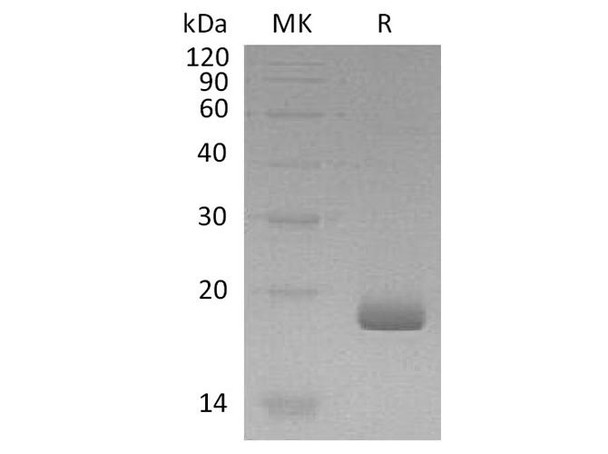 Human IFN-Lambda-3/IL-28B Recombinant Protein (RPES1493)
