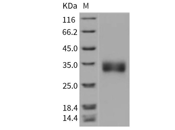 Rat Sclerostin/SOST Recombinant Protein (RPES1519)