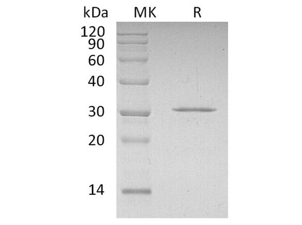 Human CDKN1B Recombinant Protein (RPES1523)