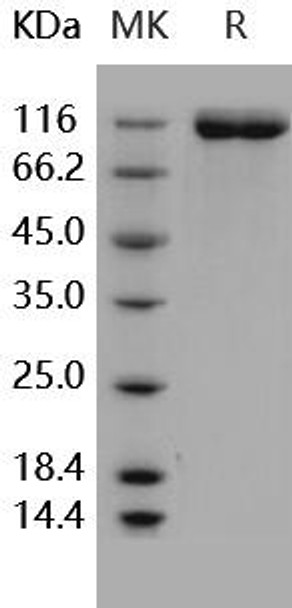 Human FLT1 Recombinant Protein (RPES1557)