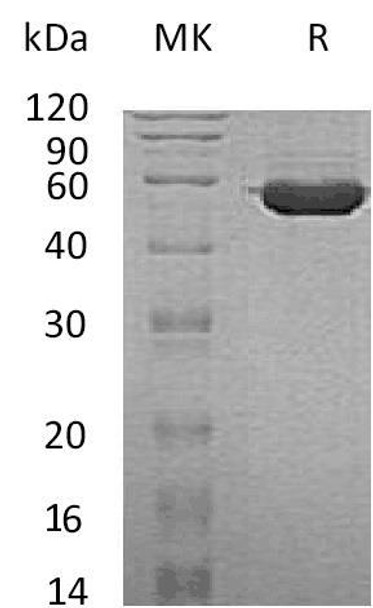 Human TINAGL1 Recombinant Protein (RPES1565)