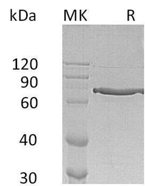 Human Cyr61/CCN1 Recombinant Protein (RPES1601)