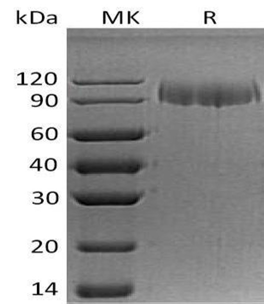 Human ITGA5 Recombinant Protein (RPES1682)