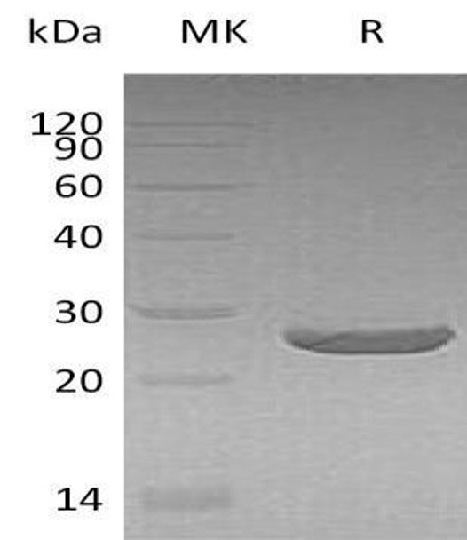 Human Peroxiredoxin 1/PRDX1 Recombinant Protein (RPES1683)