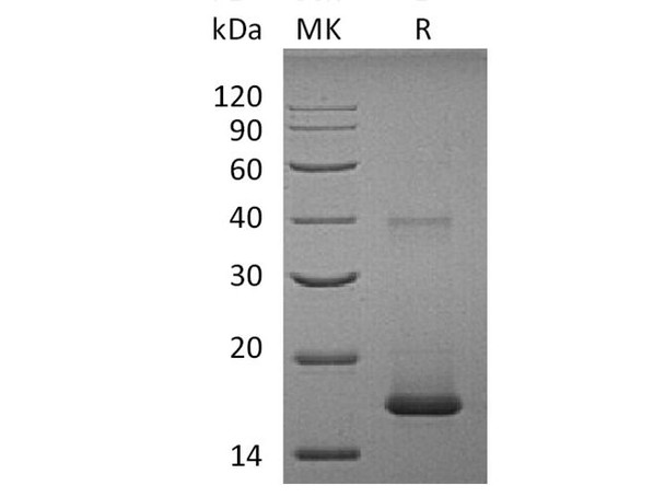 Human IL1F10/IL-38 Recombinant Protein (RPES1868)