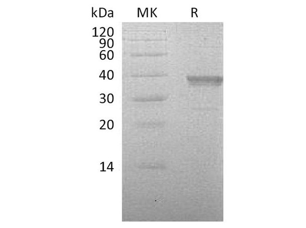 Human HABP2 Recombinant Protein (RPES1870)