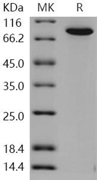 TGM2/Transglutaminase 2 Recombinant Protein (RPES1976)