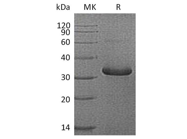 Human IGFBP/IGFBP1 Recombinant Protein (RPES1988)