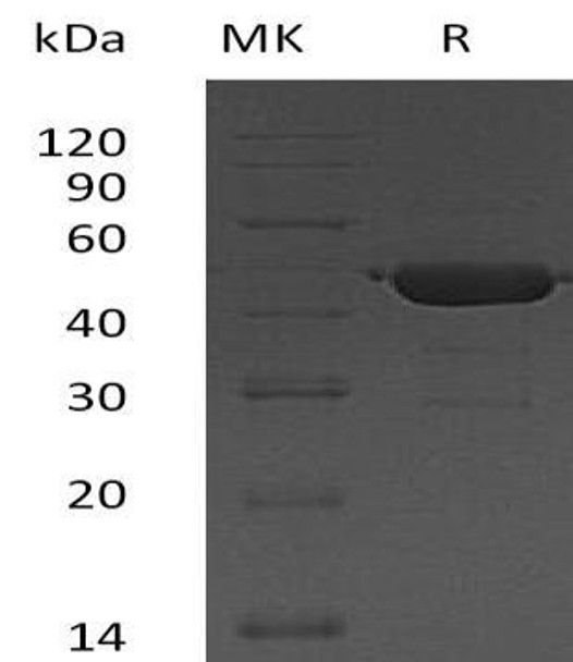 Human UBE2G2 Recombinant Protein (RPES2023)