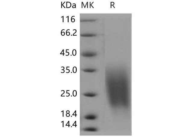 Human CREB3L1/OASIS Recombinant Protein (RPES2053)