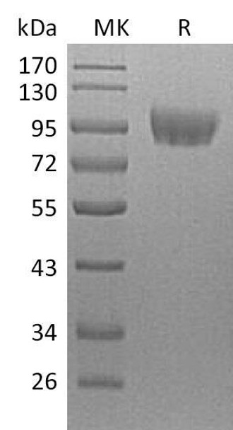 Human CD31/PECAM1 Recombinant Protein (RPES2083)