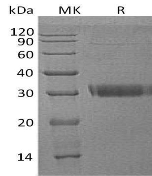 Human Adiponectin/ADIPOQ Recombinant Protein (RPES2122)