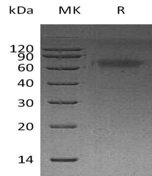 Human DKK3 Recombinant Protein (RPES2330)