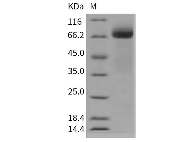Human ADAM15 Recombinant Protein (RPES2345)