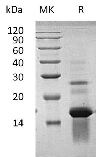 Human Amphiregulin/AREG Recombinant Protein (RPES2440)