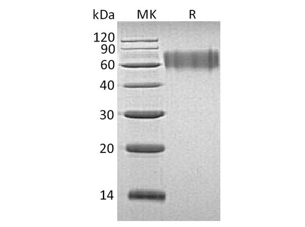 Human LYPD3 Recombinant Protein (RPES2529)