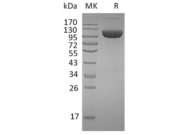 Human FGFR3/CD333 Recombinant Protein (RPES2716)