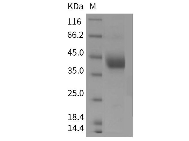 Mouse ART4/CD297 Recombinant Protein (RPES2782)