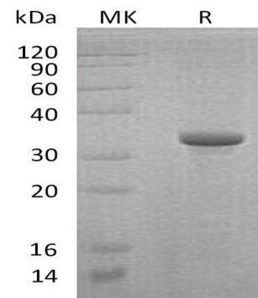 Human Endoglin/CD105 Recombinant Protein (RPES2786)