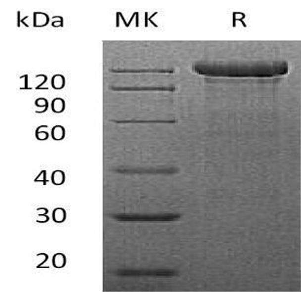 Mouse Semaphorin-4C/SEMA4C Recombinant Protein (RPES2831)