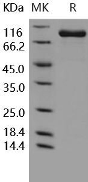 Human FAP/Seprase Recombinant Protein (RPES2979)
