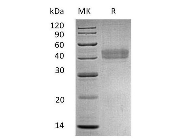 Human DKK1/Dkk Recombinant Protein (RPES3093)