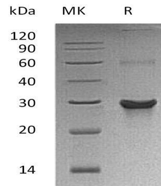 Human ATG10 Recombinant Protein (RPES3103)