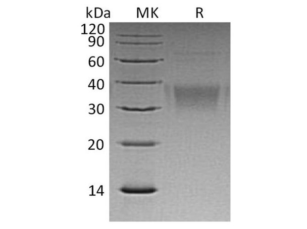 Human Ephrin-B2/EFNB2 Recombinant Protein (RPES3104)