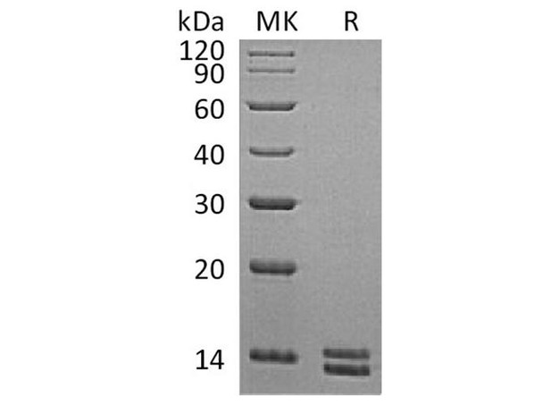 S100A8&S100A9 Heterodimer Recombinant Protein (RPES3112)