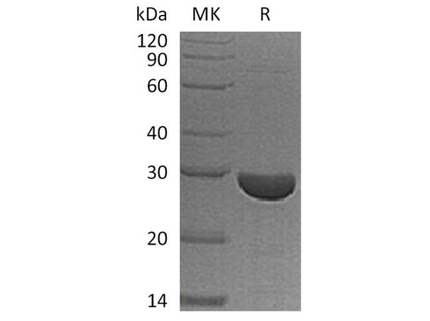 Human S100A13 Recombinant Protein (RPES3209)