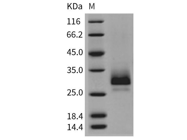 Mouse TFPI2 Recombinant Protein (RPES3216)