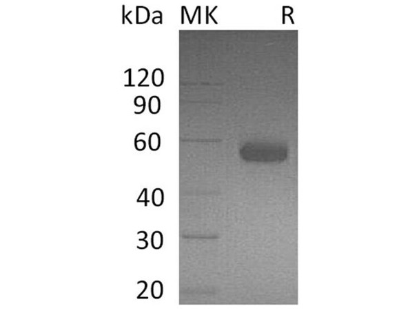 Human BTLA/CD272 Recombinant Protein (RPES3220)