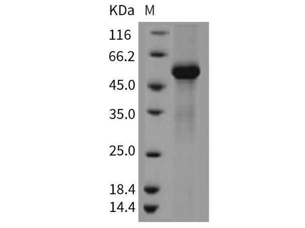 Mouse TFPI2 Recombinant Protein (RPES3237)